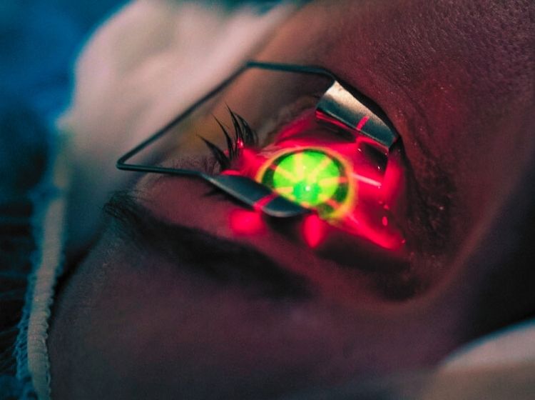 corneal-cross-linking, کراس لینکینگ, دکتر محمد ناصری چشم