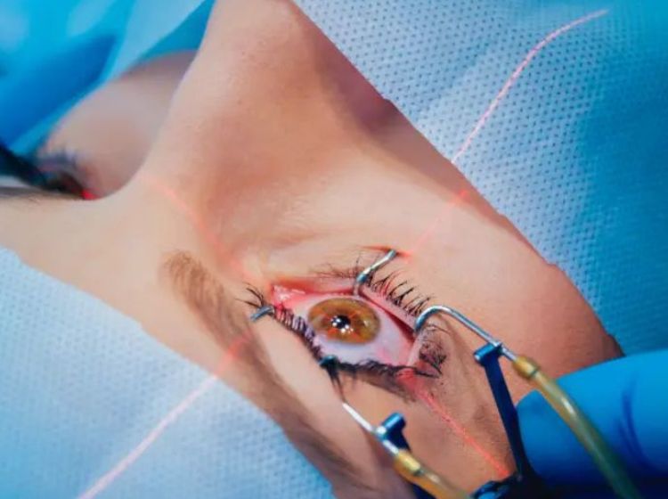 lasik-smile-naseri.jpg,دکتر محمد ناصری چشم